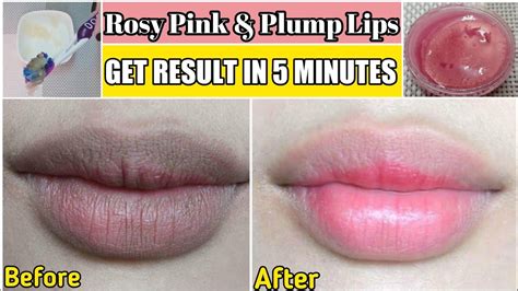 Turn Your Dark Dry Lips To Soft Pink Plump Lips In Just Minutes