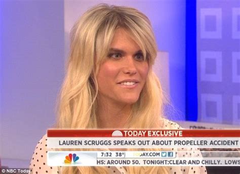 Lauren Scruggs Speaks Out About Propeller Accident On