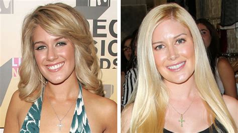 Heidi Montag On Her Plastic Surgery Past I Became Consumed By This Character I Was Playing
