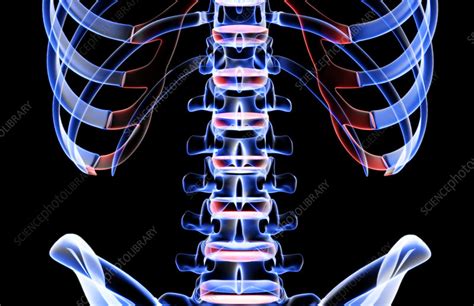 Последние твиты от about backs & bones ltd (@backsandbones). The bones of the lower back - Stock Image - F002/0086 - Science Photo Library