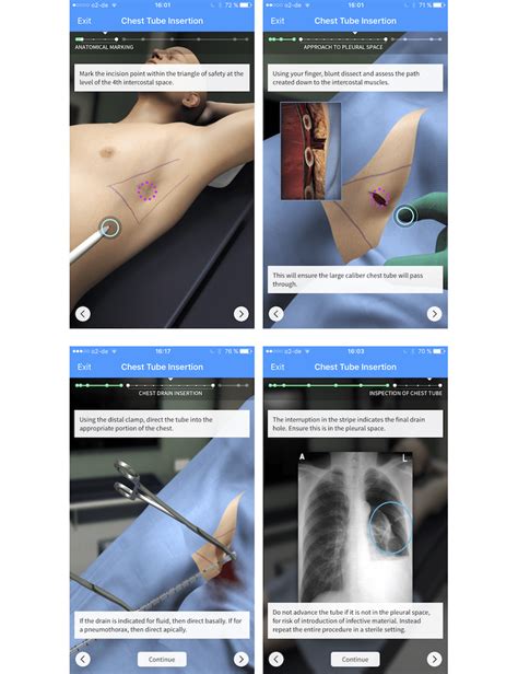 Monitor the patient throughout the Screenshots of the Touch Surgery "Chest Tube Insertion ...