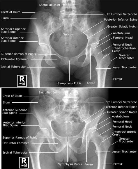 100 X Ray Anatomypositions Ideas Anatomy X Ray Radiology Technologist