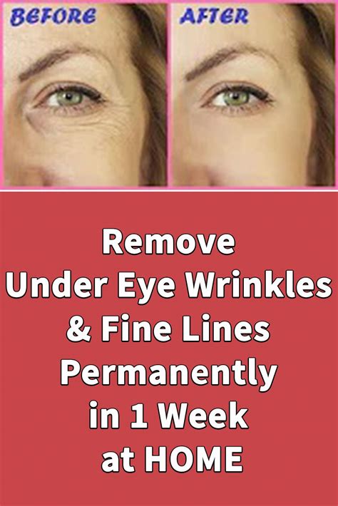 how to tighten skin under eyes without surgery 2022