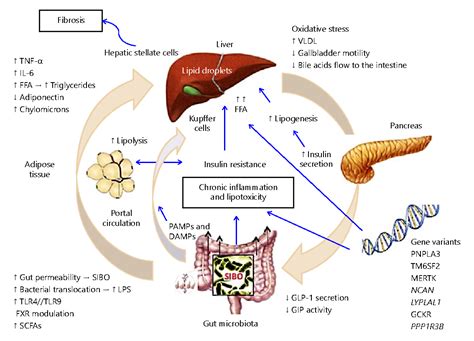 Figure 1 From Pathophysiology Of Nonalcoholic Fatty Liver Disease