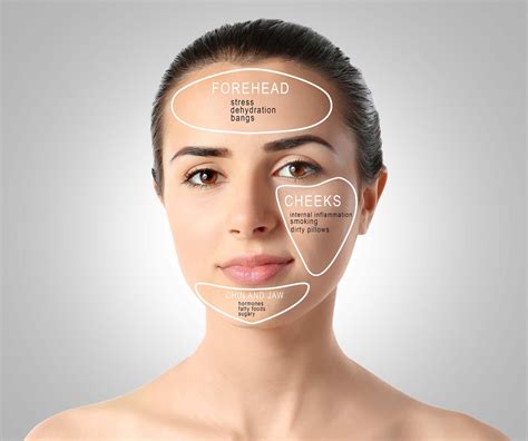 Acne Face Map What Are Your Breakouts Telling You