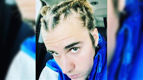 Justin Bieber Sports New Dreadlocks Hairstyle Fans Love The Calypso