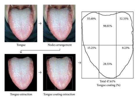 Schematic Diagram For Calculating Tongue Coating Percentage By