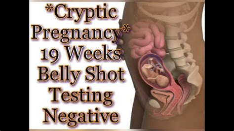 Stealth Or Cryptic Pregnancy Prenatal Vitamins