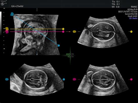 Obgyn Ultrasound Is The Field Ready To Adopt New Technology In The