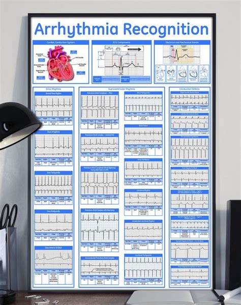 Cardiology Arrhythmia Recognition Poster
