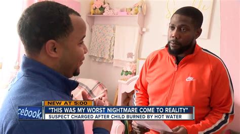 Father Reacts To 1 Year Old Being Left In Scalding Water