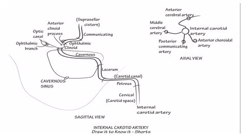 Neuroanatomy Internal Carotid Artery Draw It To Know It