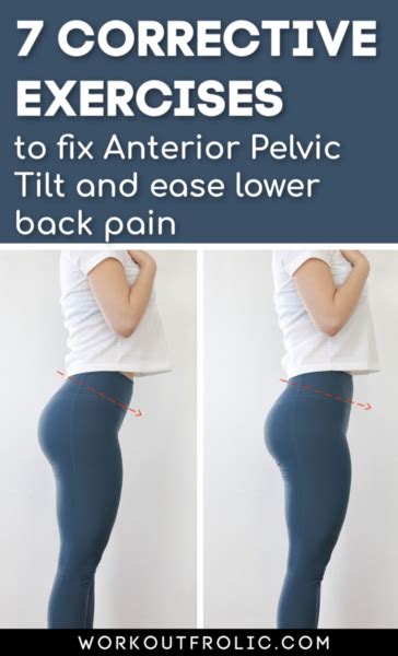 7 Anterior Pelvic Tilt Exercises To Fix A Painful Lower Back