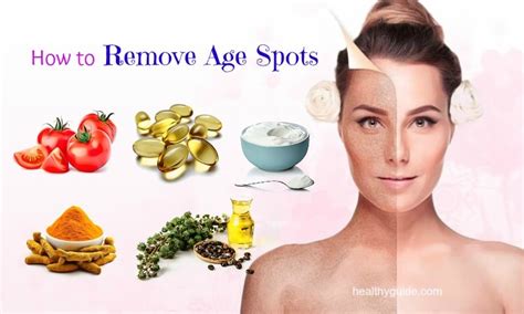 13 Tips How To Remove Age Spots On Face Hands Arms And Legs Naturally