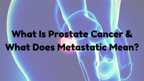 What Is Prostate Cancer What Does Metastatic Mean Youtube