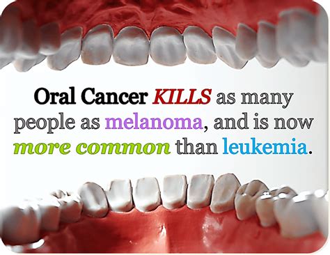 Oral Cancer The Types Causes And Treatment Dentist Says