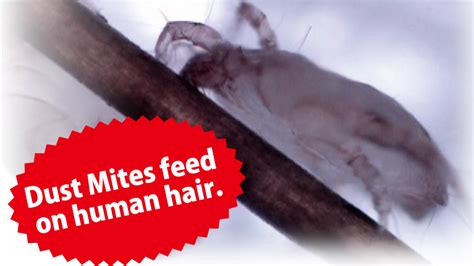 I suppose if you were constantly scratching or pulling at your hair you could create some hair loss in those areas, though the hair loss is not directly caused by mites or lice. Dust Mites_NinjaROBO