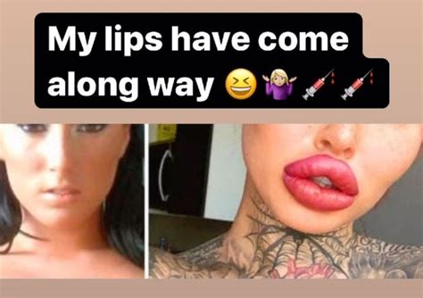 Model Who Wants World S Fattest Vagina Shares Snap Of Herself Without