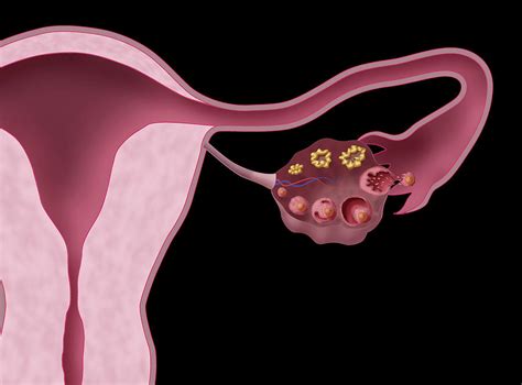 Ovarian Follicles Illustration 1 Photograph By Monica Schroeder Pixels