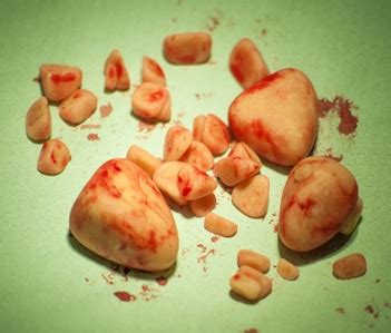 Some other tests, like blood tests, may be necessary to rule out underlying causes like diabetes or cushing's disease. Bladder Stones in Dogs: Home Remedies and Veterinary ...