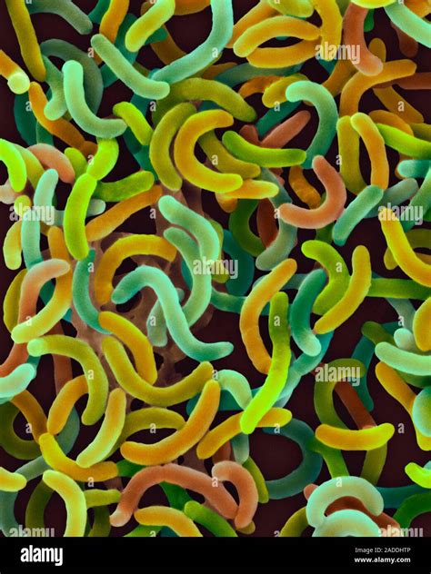 Coloured Scanning Electron Micrograph Sem Of Vibrio Cholerae Bacteria