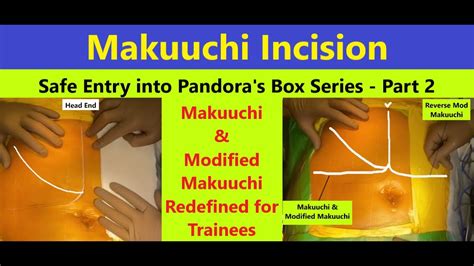 Makuuchi Incision Entry Into Pandoras Box Series Part 23 See
