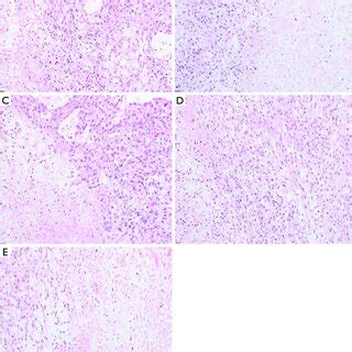 Representative Images Of Tumor And Necrosis Tissues From Nude Mice In