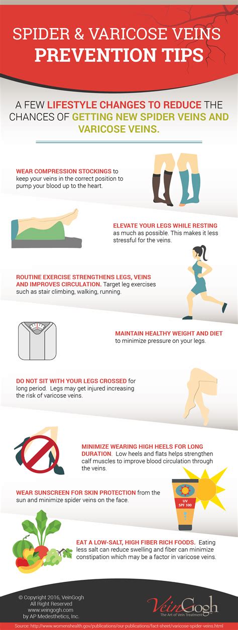 How To Prevent Spider And Varicose Veins Infographics Europe