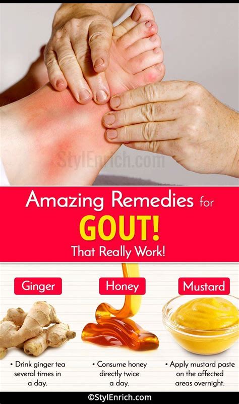 Natural Remedies For Gout In Foot