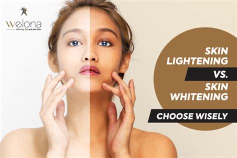 Skin Lightening Vs Skin Whitening Choose Wisely