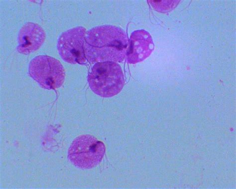 Twip 38 How To Trichomonas This Week In Parasitism