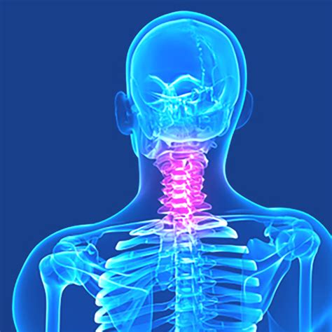 Osteoarthritis In The Lumbar Spine The Harmonic Confluence Healing