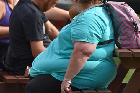 Obesidad M Rbida Qu Es Y C Mo Se Trata Cirug A De Adelgazamiento
