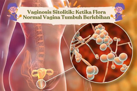 Infeksi Vagina Penyebab Gejala Dan Cara Mengobati