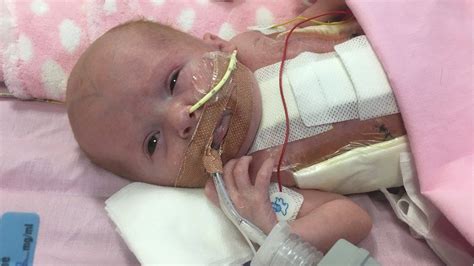 Baby Born With Heart Outside Body Is Home In Bulwell Bbc News