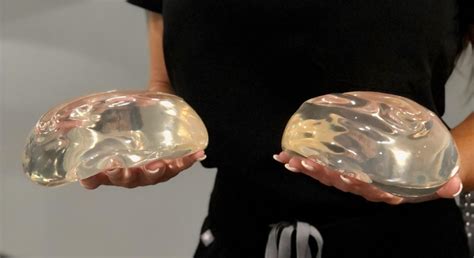 Huge Overfilled Breast Implants – Great Porn site without registration