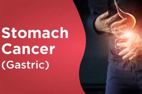 Common Early Signs Of Stomach Cancer