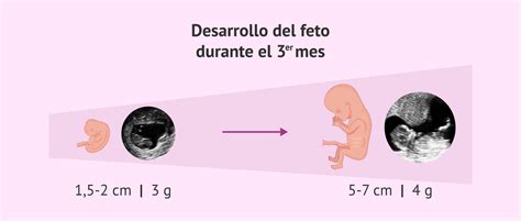 Gestação De Tres Meses