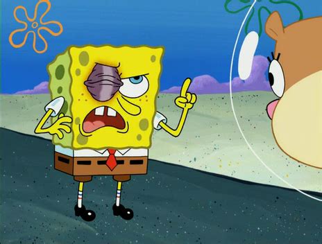 Spongebob with a black eye. SpongeBuddy Mania - SpongeBob Episode - Blackened Sponge
