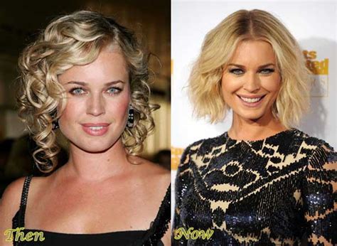 Rebecca Romijn Plastic Surgery Before And After Photos