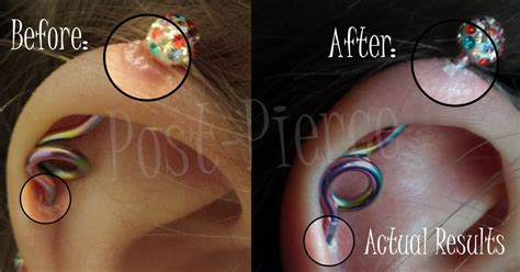 Post Pierce Is Applied With The Included Personal Applicator Wand