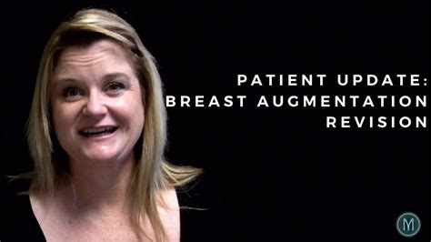 My Breast Implant Story Patient Gives An Update On Her Breast Aug In