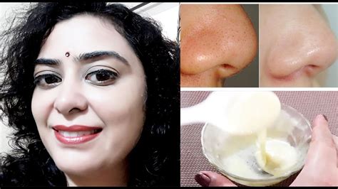 get rid of unwanted facial hair blackheads and whiteheads pooja luthra youtube