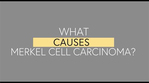 What Causes Merkel Cell Carcinoma Youtube