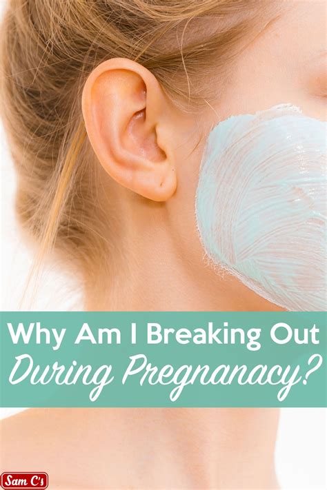 How To Treat Hormonal Pregnancy Acne
