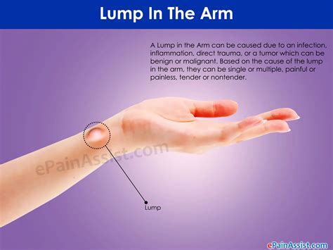Skin Cancer Bumps On Arms