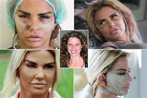 Katie Price Plastic Surgery Katie Price Left Terrified Her Ears Might Fall Off After Face Lift