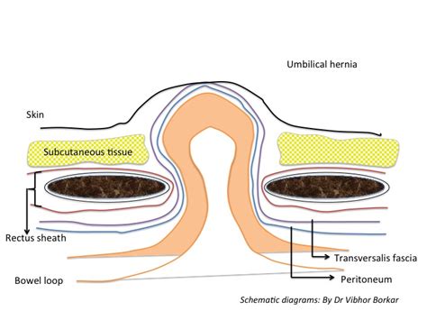 Umbilicus Anatomy