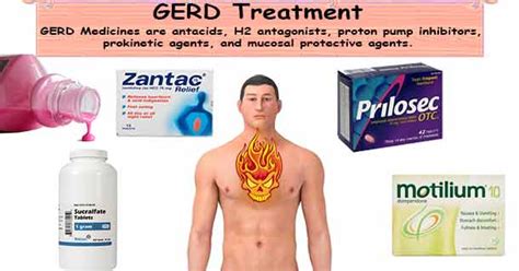 Acid Reflux Treatment Gerd Treatment Acid Reflux Medication