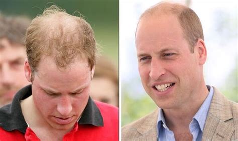 British Royal News Prince Harry Takes A Jab At Prince Williams Hair